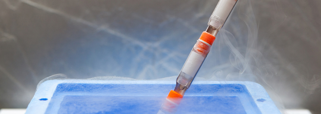 Esco CelCulture® CCL-170-IVF